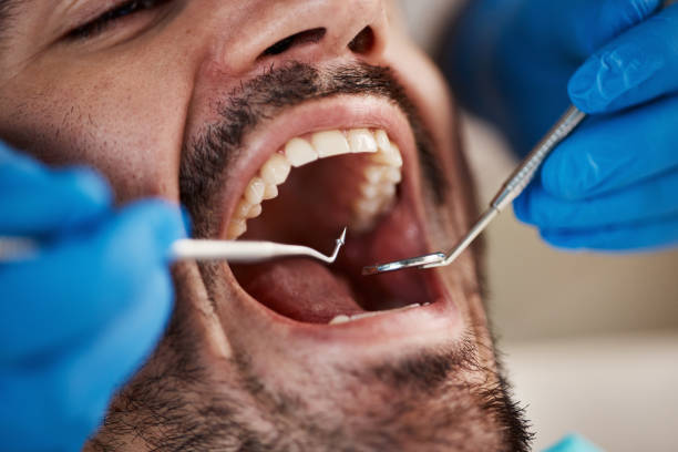 Best Emergency Root Canal Treatment in Shell Valley, ND